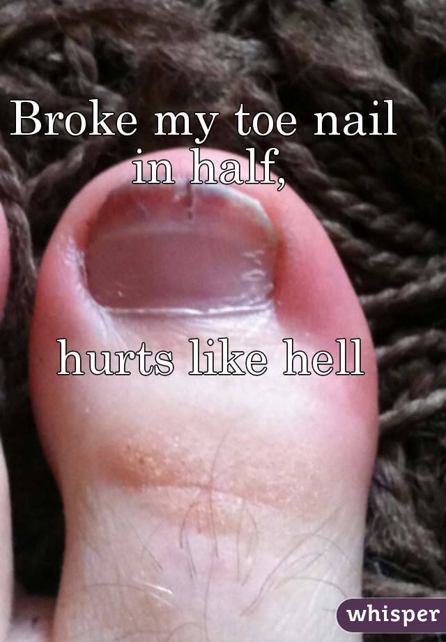 Broke my toe nail in half,



 hurts like hell