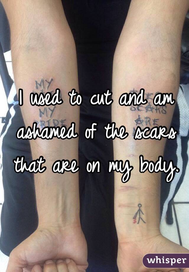 I used to cut and am ashamed of the scars that are on my body. 