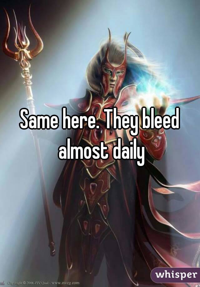 Same here. They bleed almost daily