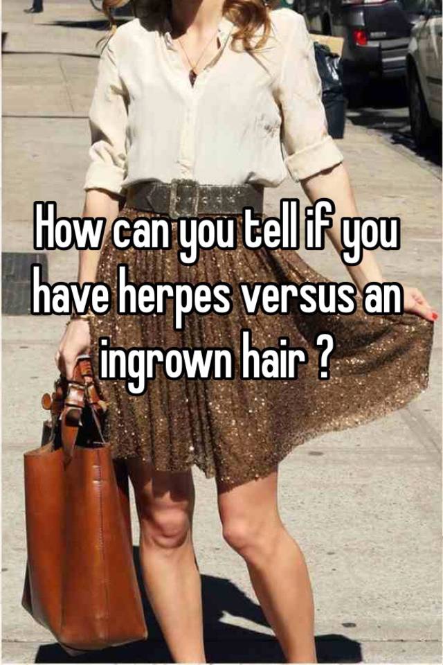 How Can You Tell If You Have Herpes Versus An Ingrown Hair