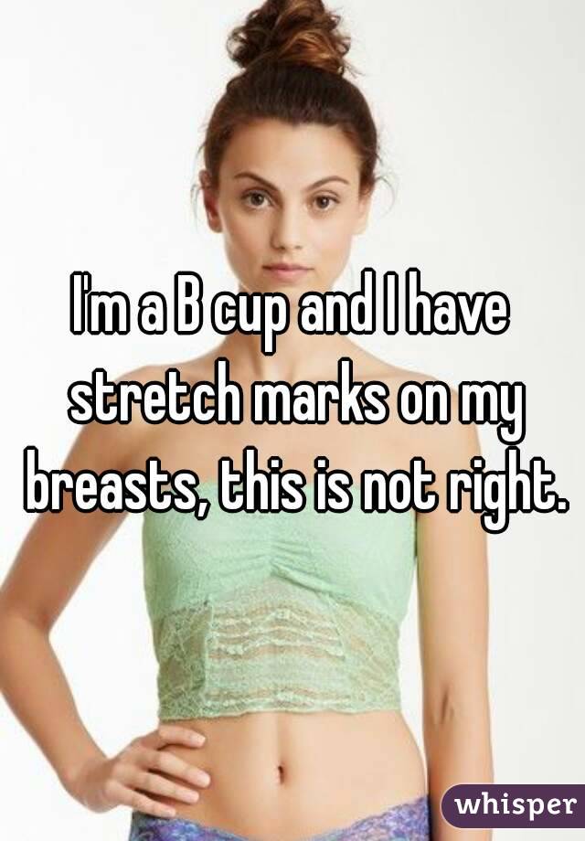 I'm a B cup and I have stretch marks on my breasts, this is not right.