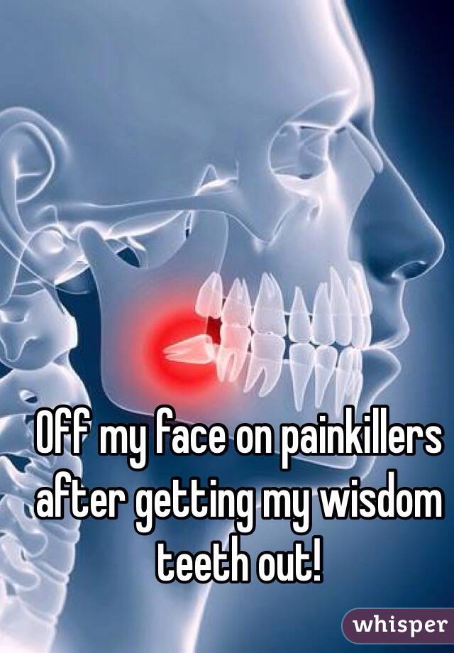 Off my face on painkillers after getting my wisdom teeth out!