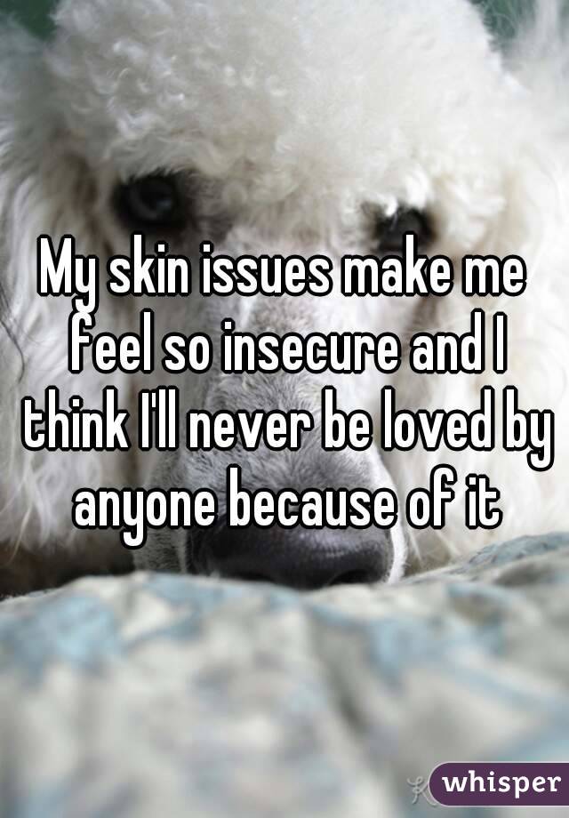 My skin issues make me feel so insecure and I think I'll never be loved by anyone because of it