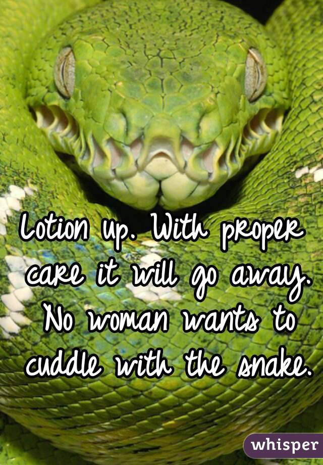 Lotion up. With proper care it will go away. No woman wants to cuddle with the snake.