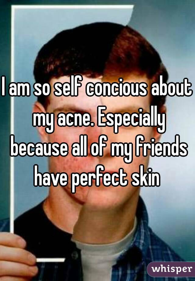 I am so self concious about my acne. Especially because all of my friends have perfect skin 