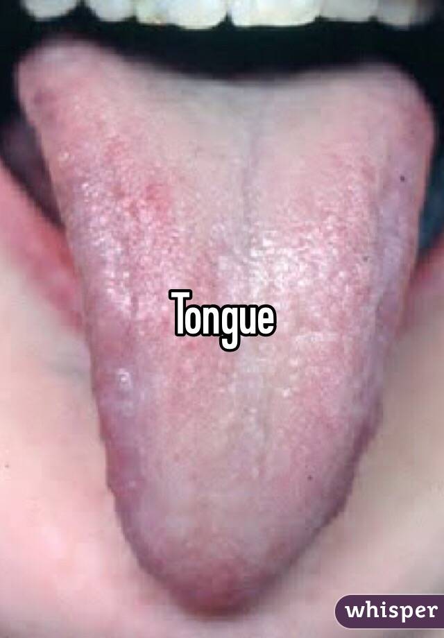 Tongue