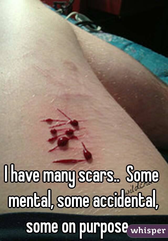 I have many scars..  Some mental, some accidental, some on purpose... 