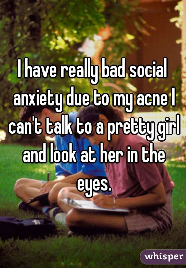 I have really bad social anxiety due to my acne I can't talk to a pretty girl and look at her in the eyes.