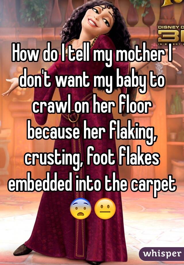 How do I tell my mother I don't want my baby to crawl on her floor because her flaking, crusting, foot flakes embedded into the carpet
😨😐