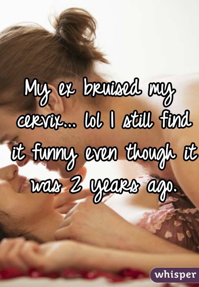 My ex bruised my cervix... lol I still find it funny even though it was 2 years ago.