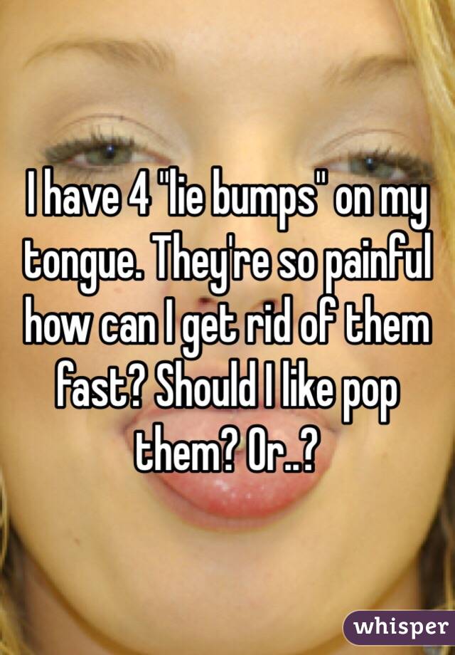I have 4 "lie bumps" on my tongue. They're so painful how can I get rid of them fast? Should I like pop them? Or..?