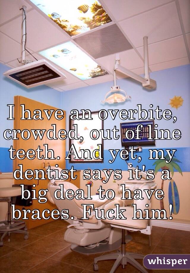 I have an overbite, crowded, out of line teeth. And yet, my dentist says it's a big deal to have braces. Fuck him!