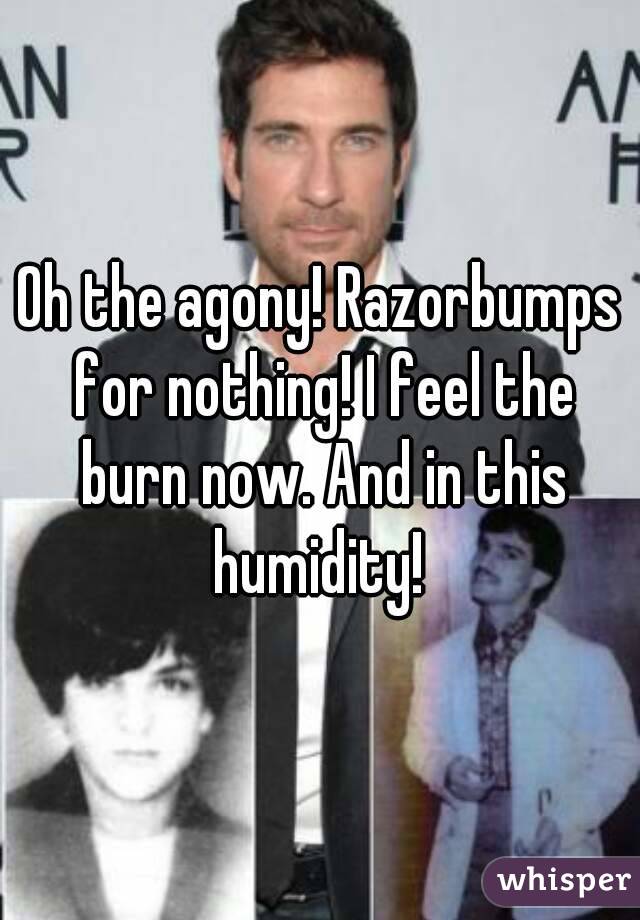 Oh the agony! Razorbumps for nothing! I feel the burn now. And in this humidity! 