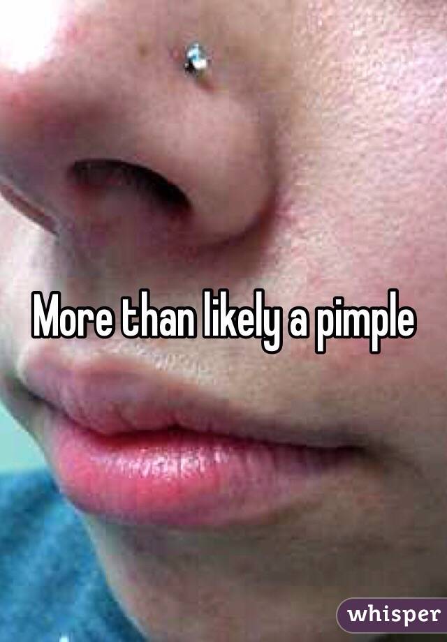 More than likely a pimple 