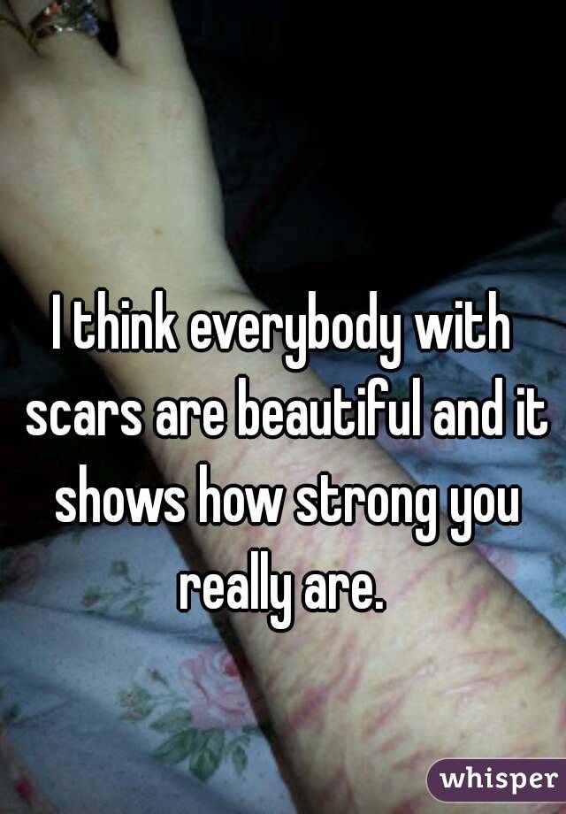 I think everybody with scars are beautiful and it shows how strong you really are. 