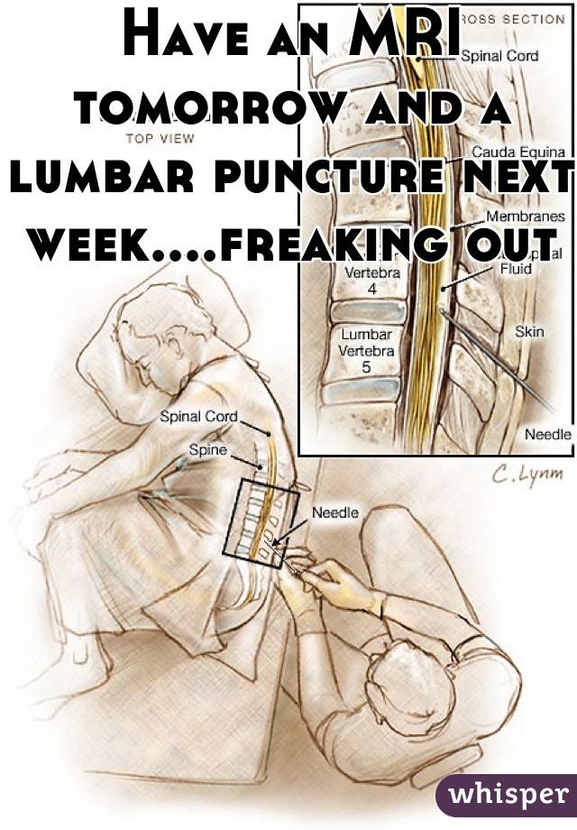 Have an MRI tomorrow and a lumbar puncture next week....freaking out
