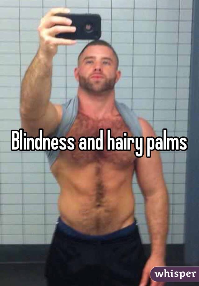 Blindness and hairy palms