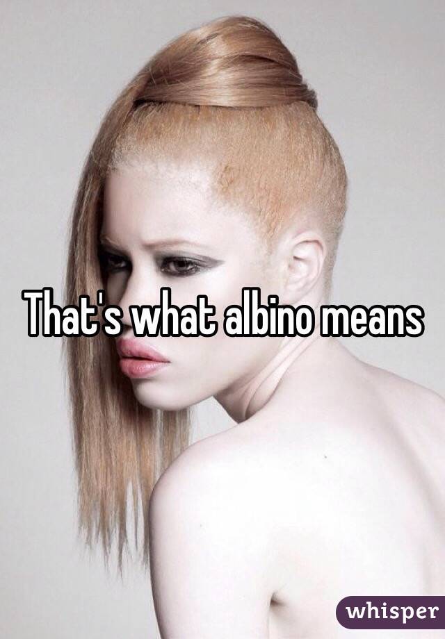 That's what albino means 