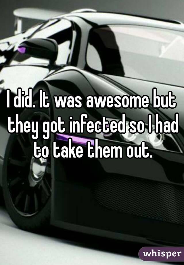 I did. It was awesome but they got infected so I had to take them out.