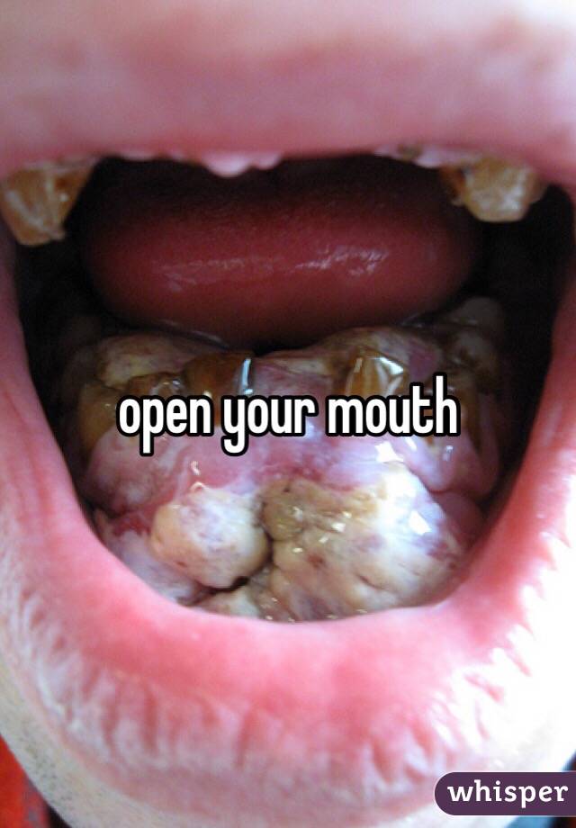 open your mouth