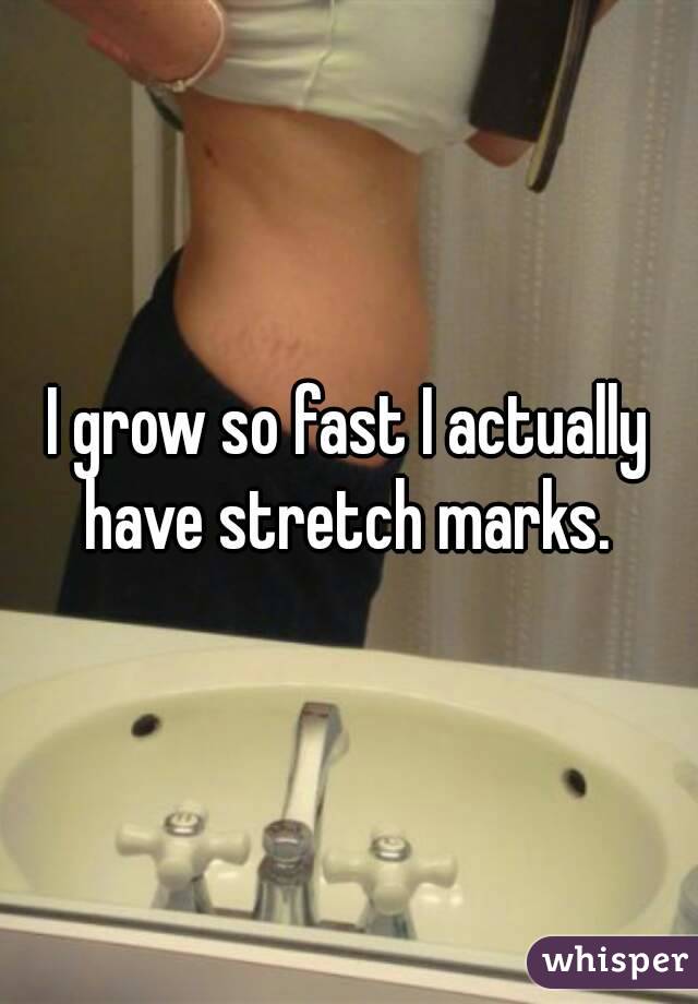 I grow so fast I actually have stretch marks. 