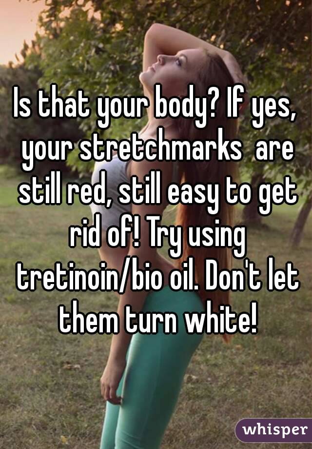 Is that your body? If yes, your stretchmarks  are still red, still easy to get rid of! Try using tretinoin/bio oil. Don't let them turn white!