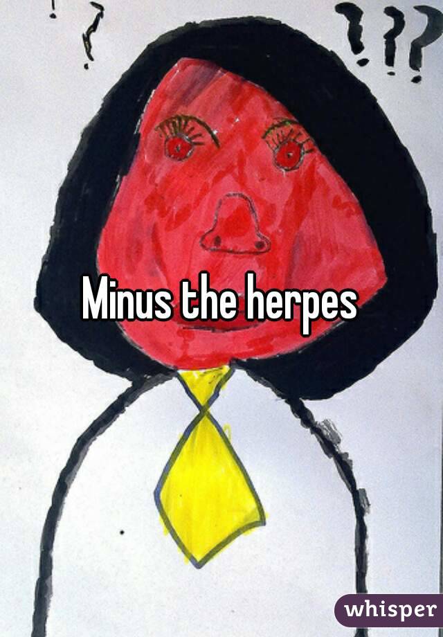 Minus the herpes