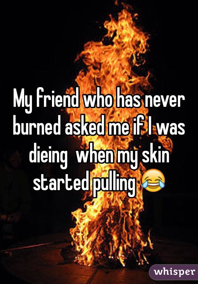 My friend who has never burned asked me if I was dieing  when my skin started pulling 😂