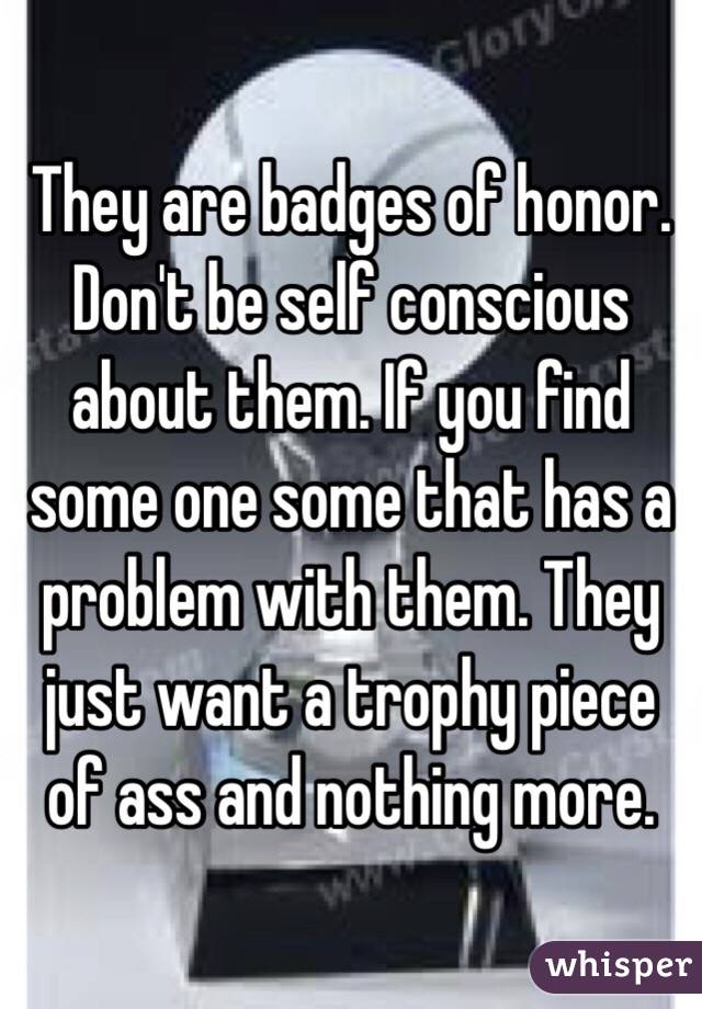 They are badges of honor. Don't be self conscious about them. If you find some one some that has a problem with them. They just want a trophy piece of ass and nothing more.