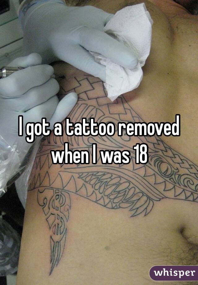 I got a tattoo removed when I was 18