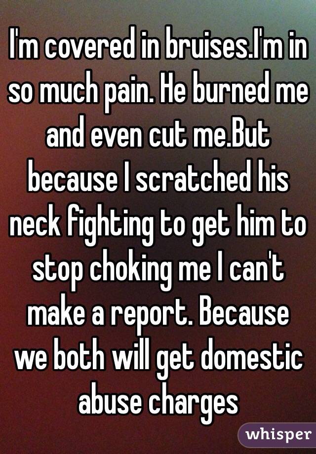 I'm covered in bruises.I'm in so much pain. He burned me and even cut me.But because I scratched his neck fighting to get him to stop choking me I can't make a report. Because we both will get domestic abuse charges 