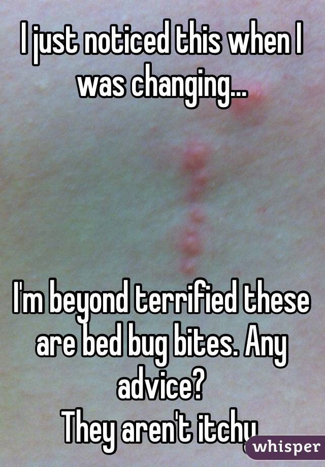 I just noticed this when I was changing... 




I'm beyond terrified these are bed bug bites. Any advice?
They aren't itchy. 