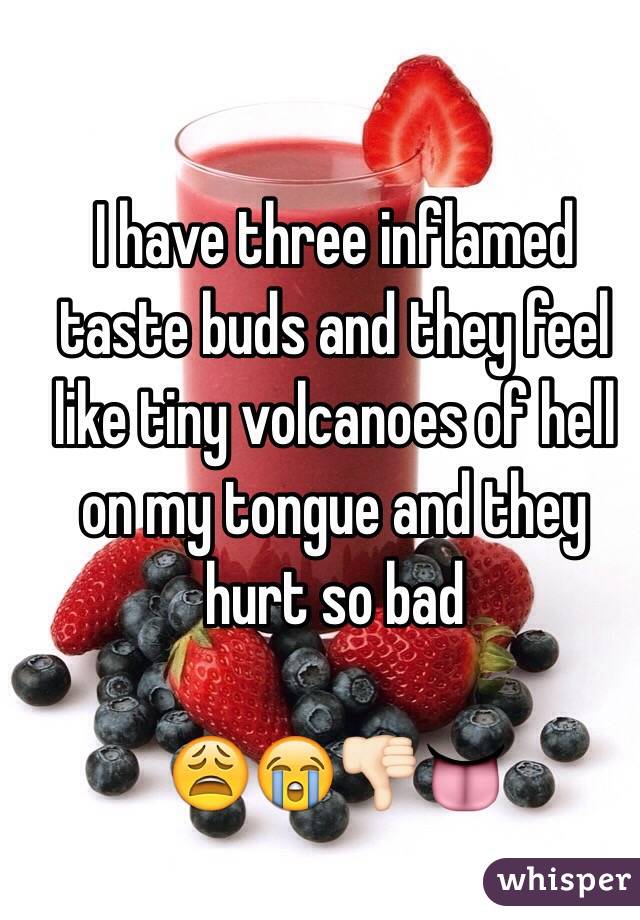 I have three inflamed taste buds and they feel like tiny volcanoes of hell on my tongue and they hurt so bad

😩😭👎🏻👅