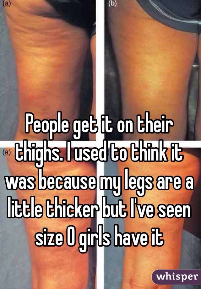 People get it on their thighs. I used to think it was because my legs are a little thicker but I've seen size 0 girls have it 