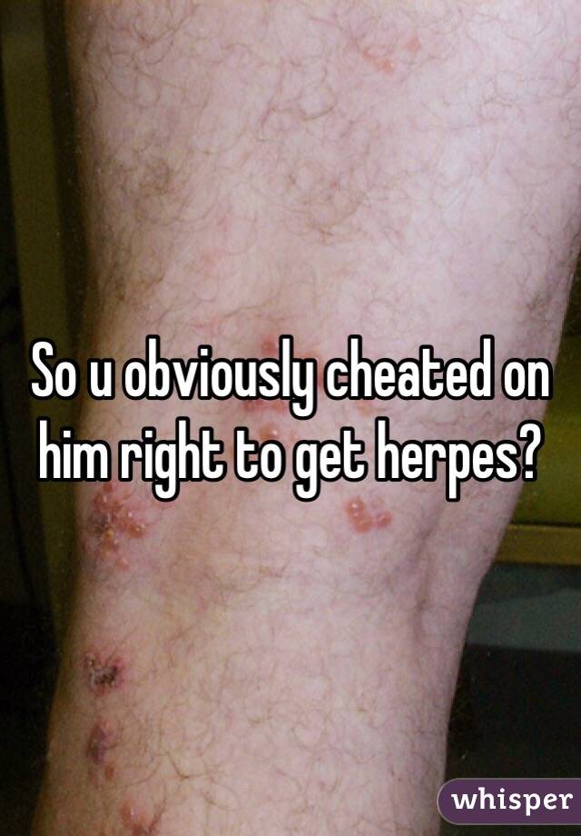 So u obviously cheated on him right to get herpes?