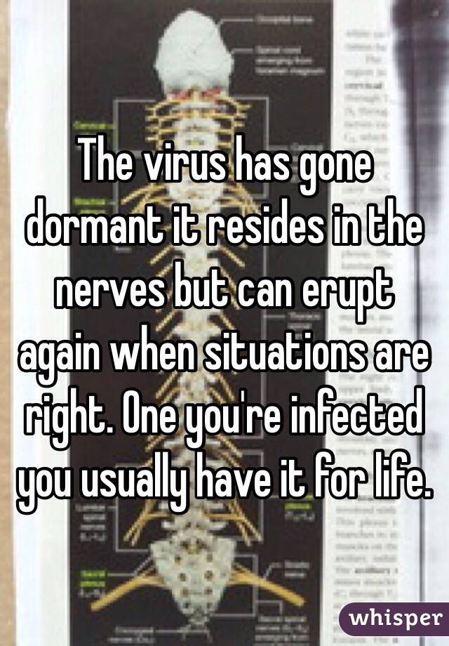 The virus has gone dormant it resides in the nerves but can erupt again when situations are right. One you're infected you usually have it for life. 