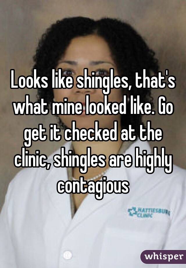 Looks like shingles, that's what mine looked like. Go get it checked at the clinic, shingles are highly contagious 