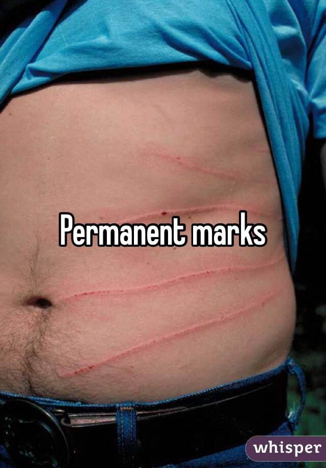 Permanent marks 