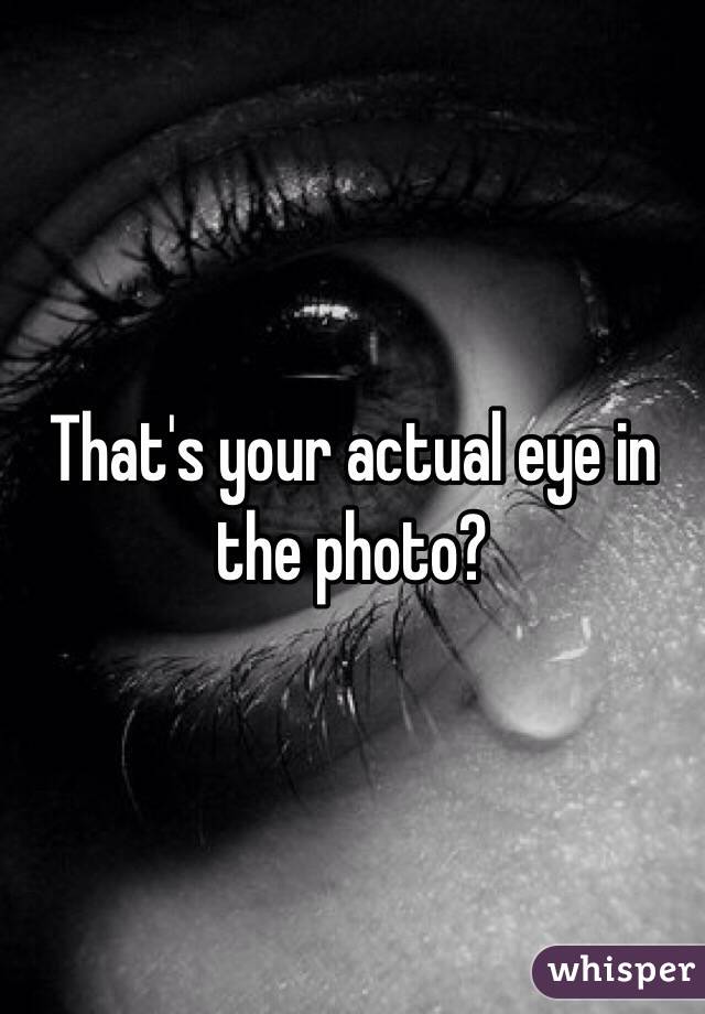 That's your actual eye in the photo?