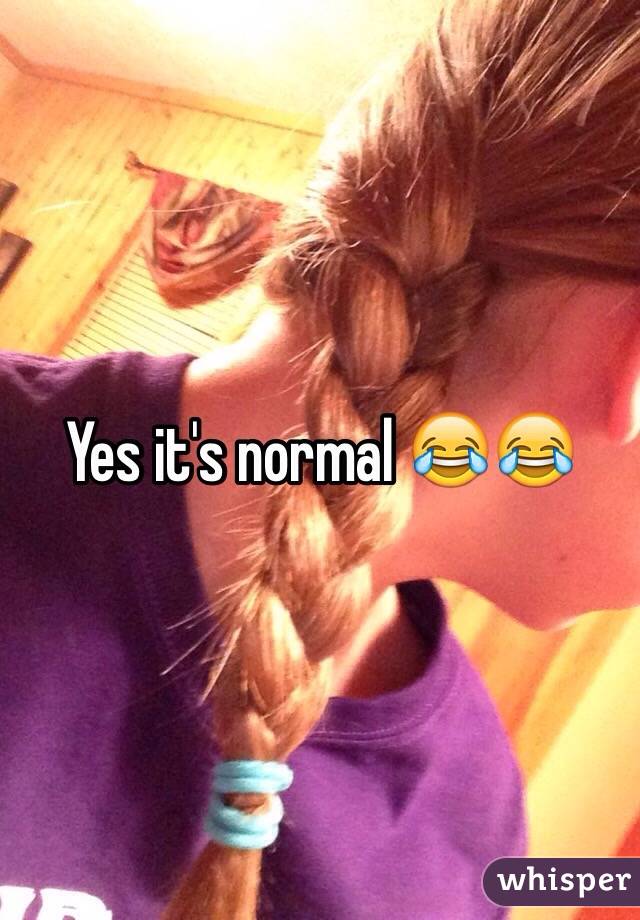 Yes it's normal 😂😂
