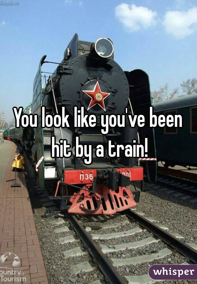 You look like you've been hit by a train!
