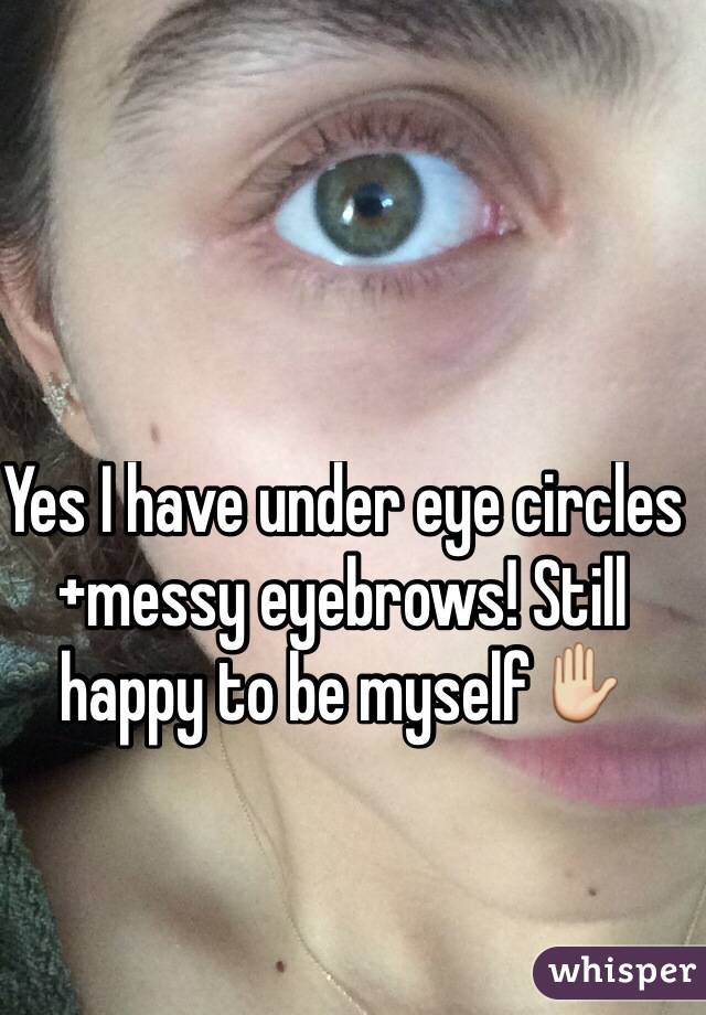 Yes I have under eye circles+messy eyebrows! Still happy to be myself✋
