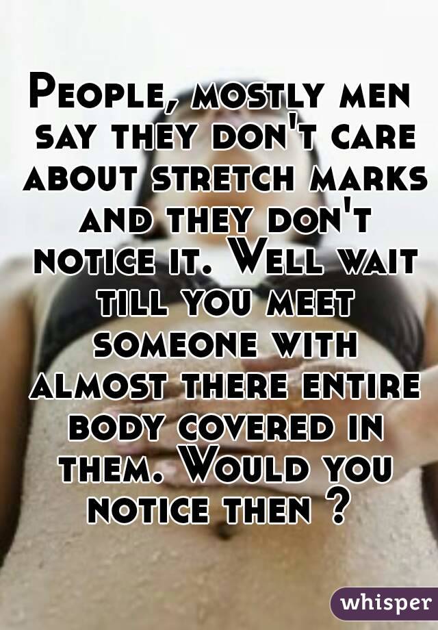 People, mostly men say they don't care about stretch marks and they don't notice it. Well wait till you meet someone with almost there entire body covered in them. Would you notice then ? 
