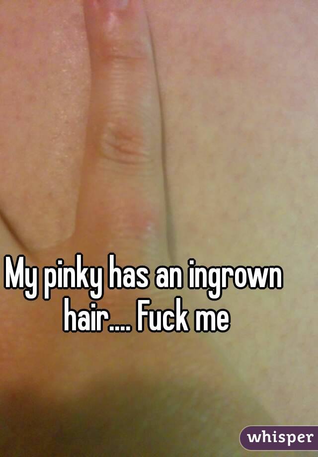 My pinky has an ingrown hair.... Fuck me