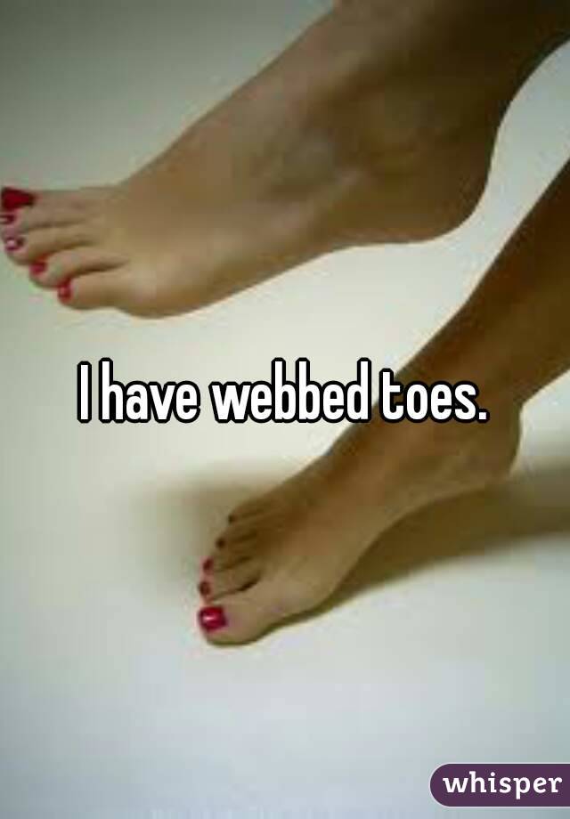 I have webbed toes.