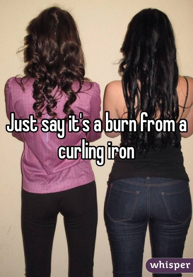 Just say it's a burn from a curling iron