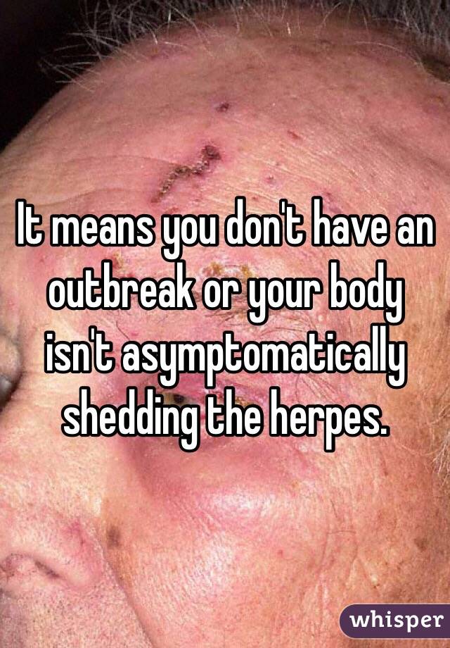 It means you don't have an outbreak or your body isn't asymptomatically shedding the herpes. 