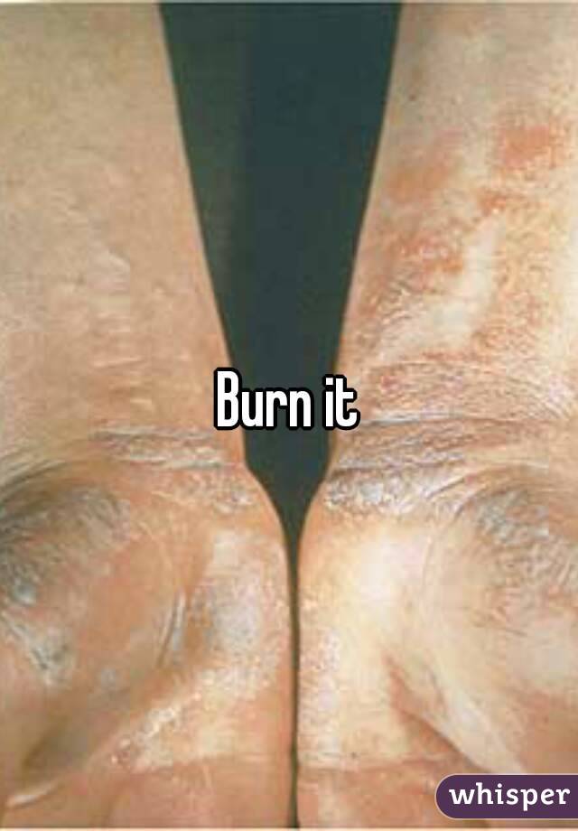 Burn it