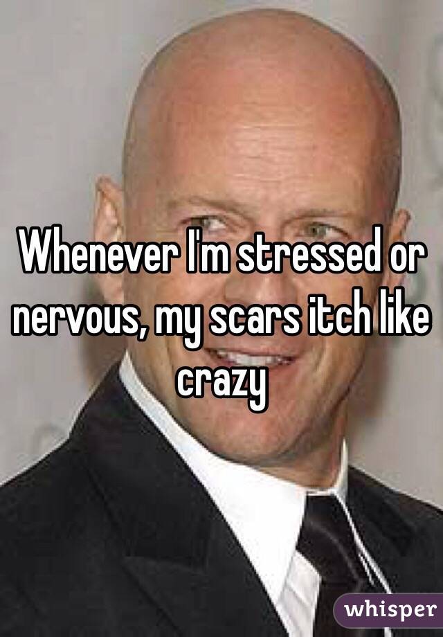 Whenever I'm stressed or nervous, my scars itch like crazy