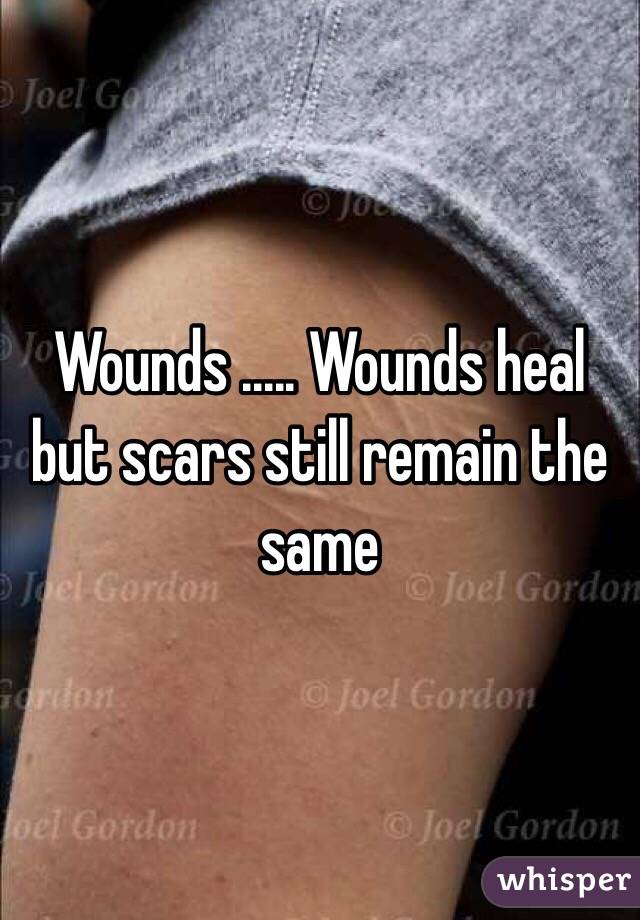 Wounds ..... Wounds heal but scars still remain the same 